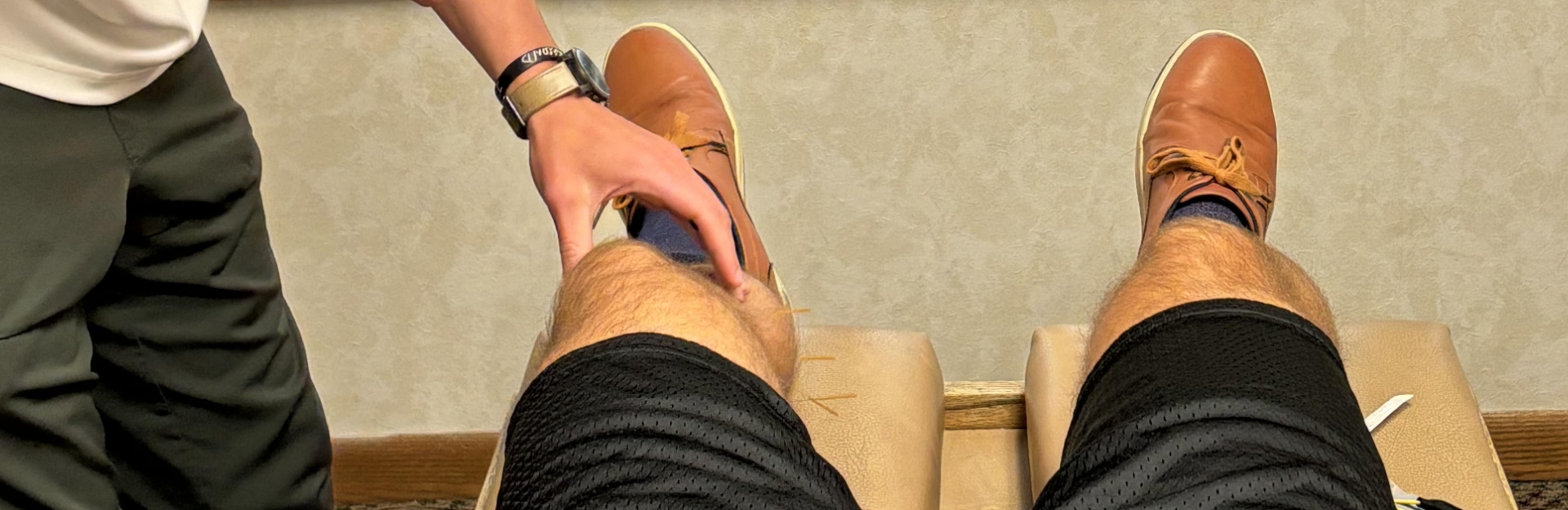 Dry Needling